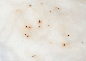 Ultimate Guide to Flea Control for Dogs and Cats flea dirt